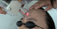 Most Advanced: 10600nm professional fractional co2 laser