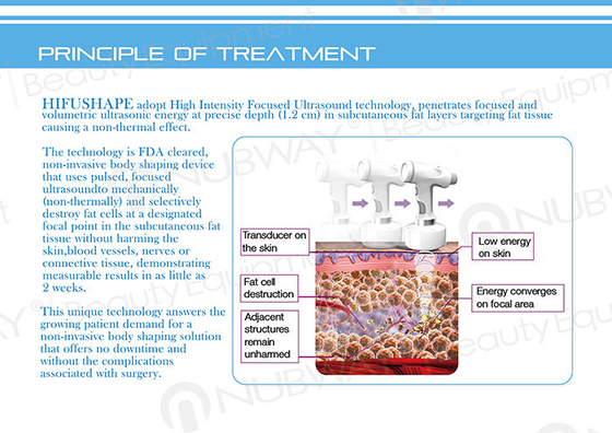 2015 HIFUSHAPE !!! hifu body slimming beauty equipment body contouring hifu ultrashape