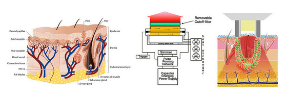 Spa shr ipl hair removal machine,SHR and IPL handpiece with optimal efficacy,safety and ea