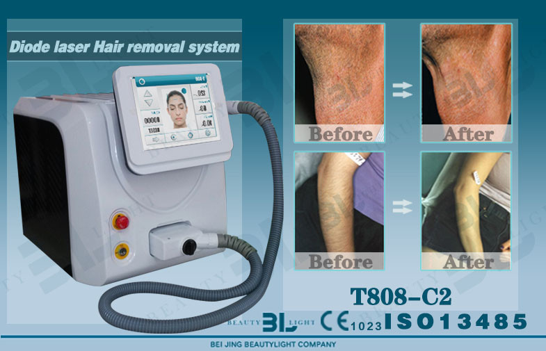 Diode home laser hair removal machines Long Pulse with High Energy